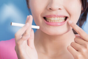 Smoking and Teeth Implants
