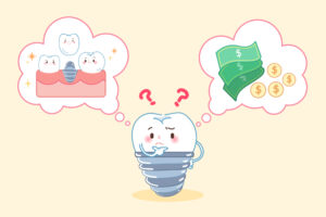 Cost of Dental Implants