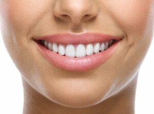 Top Signs That Your Smile is on the Path to Dental Implants