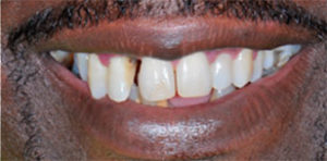 Darrell Before Teeth