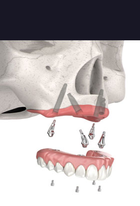 pterygoid