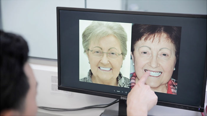 dental implants dallas
